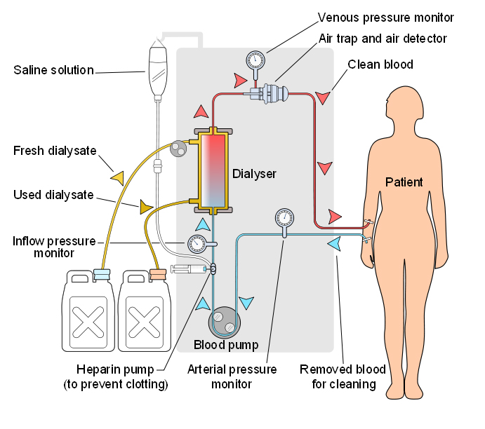 Dialysis